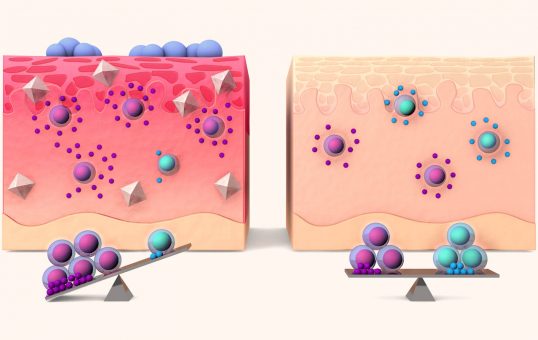 Infografik: Salz und seine Auswirkungen auf das Immunsystem / Design Daniela Leitner